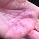 Ochayon’s hand.